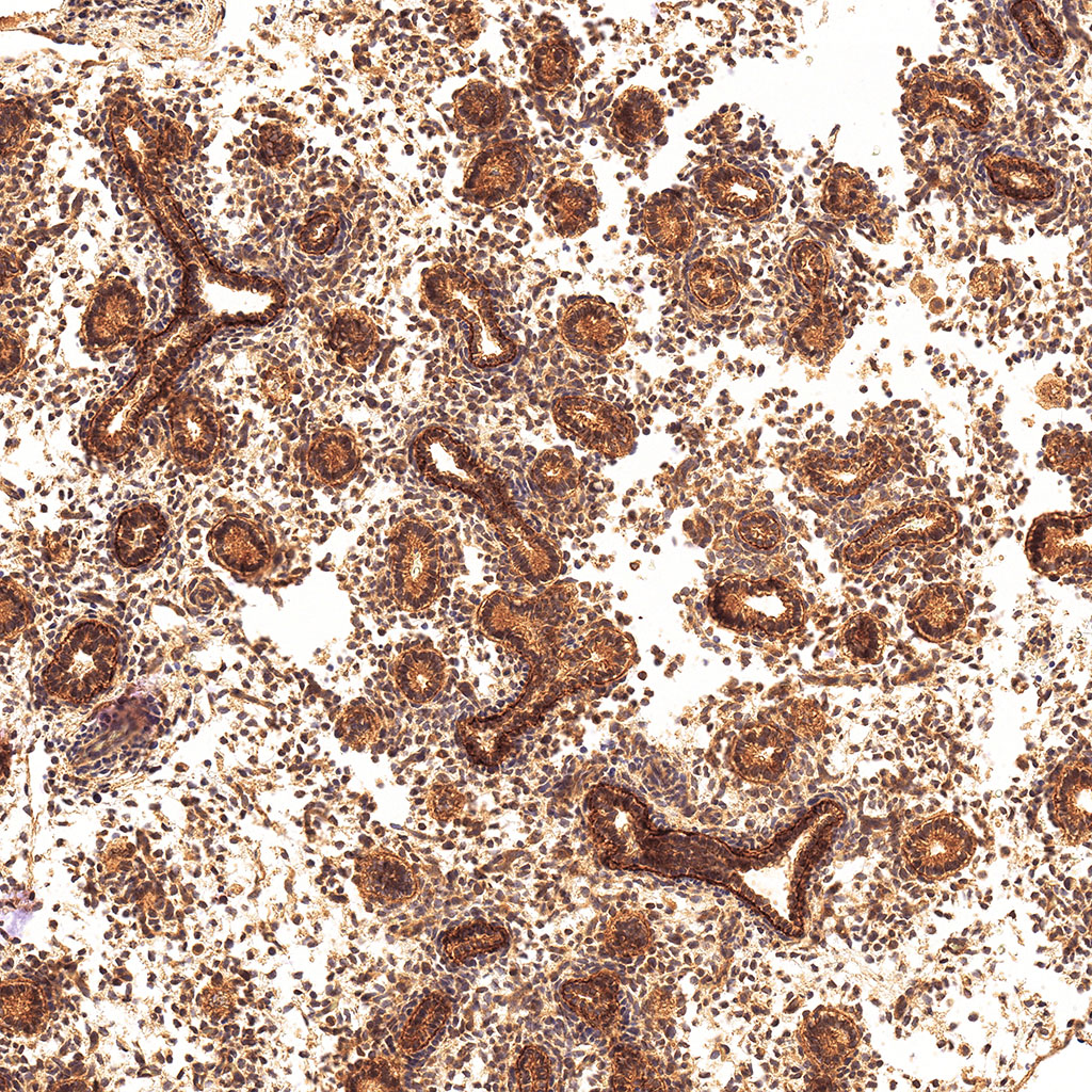 sars-cov-2 gene expression in a human fetus